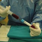 Μεσεγχυματικά Βλαστοκύτταρα για την Θεραπεία του Εκφυλισμένου Μεσοσπονδύλιου Δίσκου