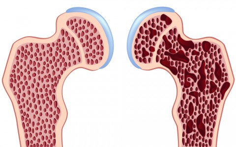 Internal Fixation