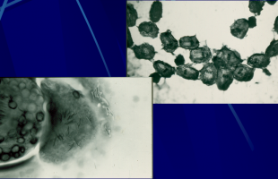 Εχινοκοκκος