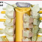 Πεταλο-πλαστική