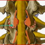 Πεταλεκτομή