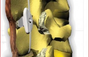 Principles of effective dynamic stabilizations