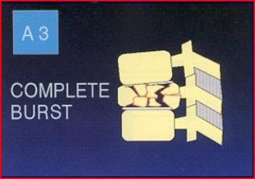 Lumbar Injuries