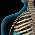 Neck Pain | Cervical Disc Injury | Nucleus Health