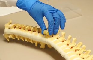 This material could help patients with damaged spine