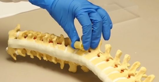 This material could help patients with damaged spine