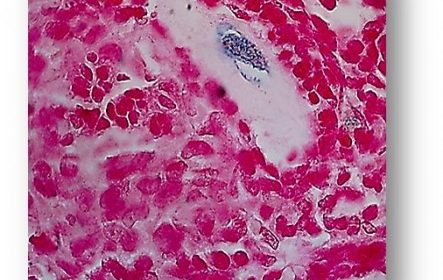 Βλαστοκύτταρα (Stem cells) στη Σπονδυλική Στήλη