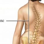 Ομιλία: Ιδιοπαθής Σκολίωση και Αντιμετώπιση