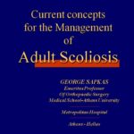 Current concepts for the Management of Adult Scoliosis