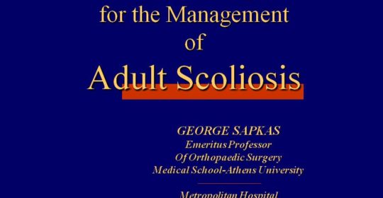 Current concepts for the Management of Adult Scoliosis