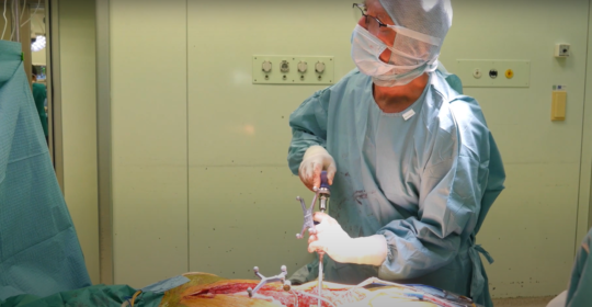 Χειρουργική διόρθωση σκολίωσης – Νευρομυϊκής αιτιολογίας
