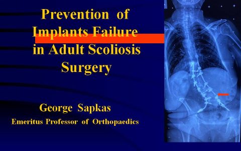 PREVENTION OF IMPLANTS FAILURE IN SPINE SURGERY