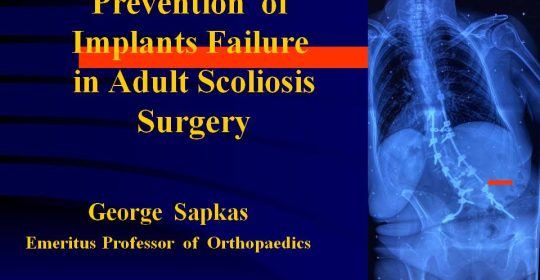 PREVENTION OF IMPLANTS FAILURE IN SPINE SURGERY